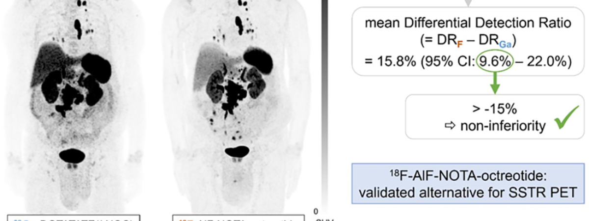 teranostik, radyofarmasötik