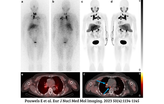 teranostik, radyofarmasötik